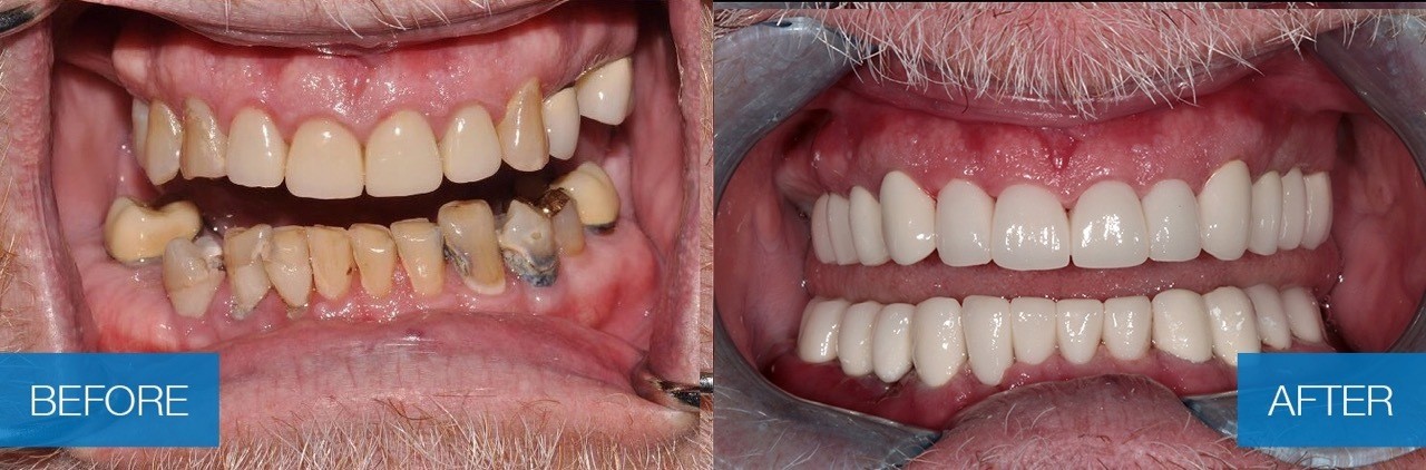 Poliklinika Bagatin_Lowrie Mccown_before&after1