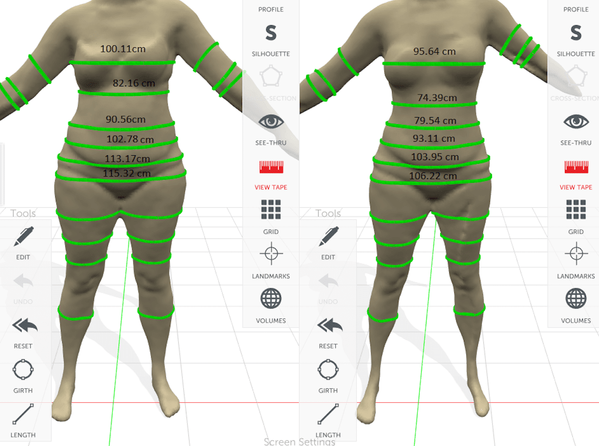 Poliklinika Bagatin Split & Zagreb_STYKU_WEIGHT AND FAT LOSS BAGATIN SPLIT